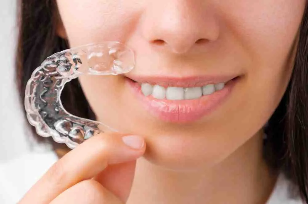 Clear braces treatment