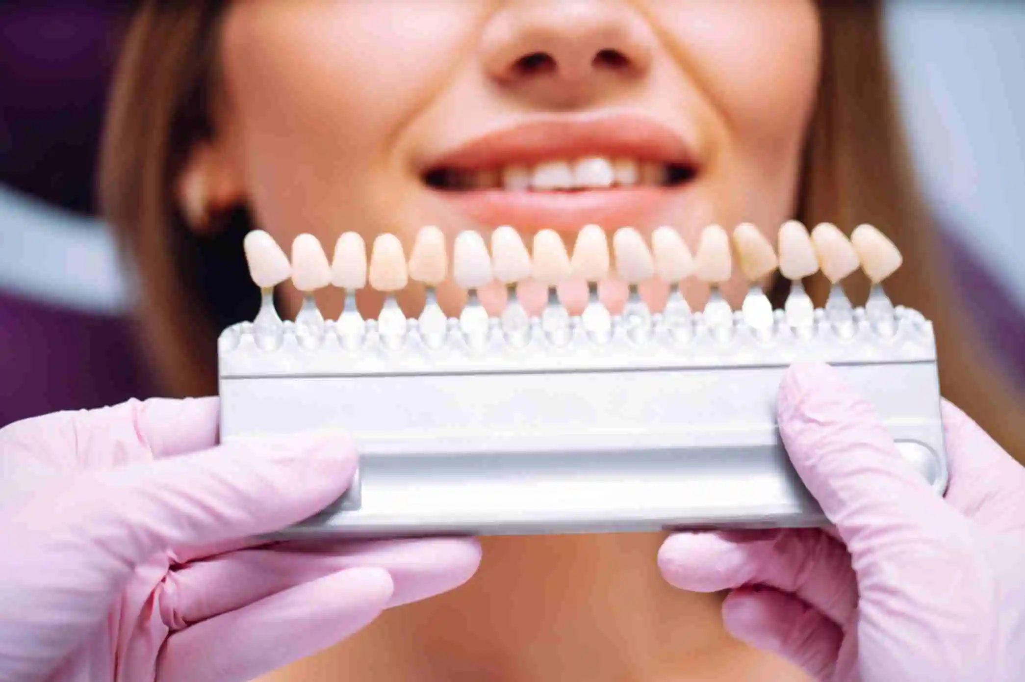 Dental implants at our access dental center
